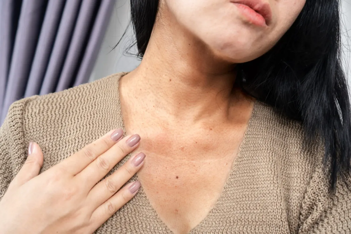 Poiquilodermia — Dermatologia Clínica na Clínica Mansur em Juiz de Fora